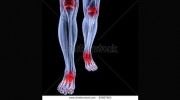 Carrie Stirrup State Registered Podiatrist