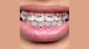 Ipswich Emergency Dentist