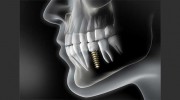 Confidental Dental Care