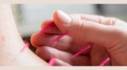 Holyrood Acupuncture Practice