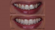 Aura Dental London